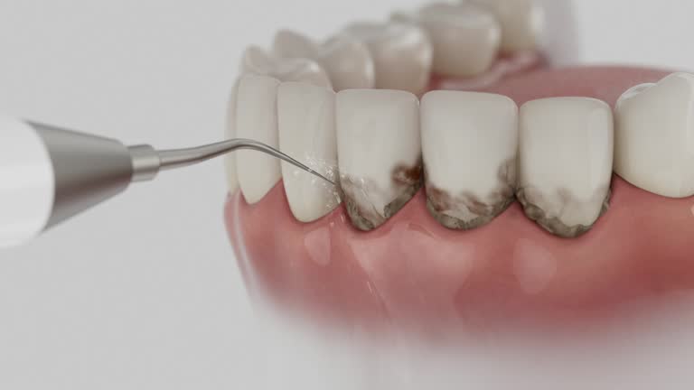 Trusted Root Canal Treatment service in Chandler, TX - Dentist Open Now